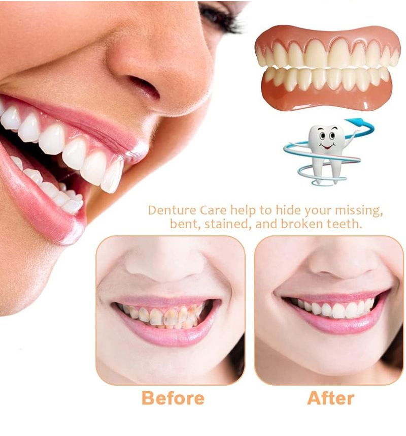 Fourth generation instant smile dentures with silicone simulated teeth, whitening braces, and smiling dentures