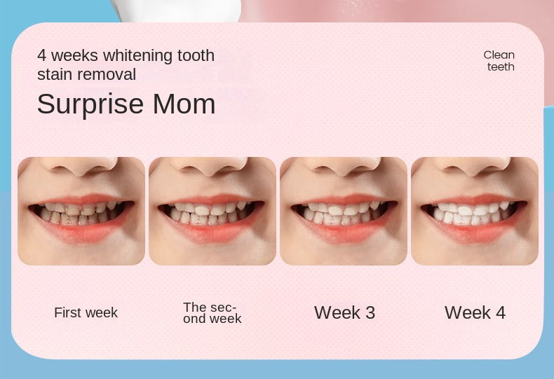 2023 Children's Electric Toothbrush USB Sonic Toothbrush Boys Cartoon Kids with Replacement Girls Toothbrush Ultrasonic