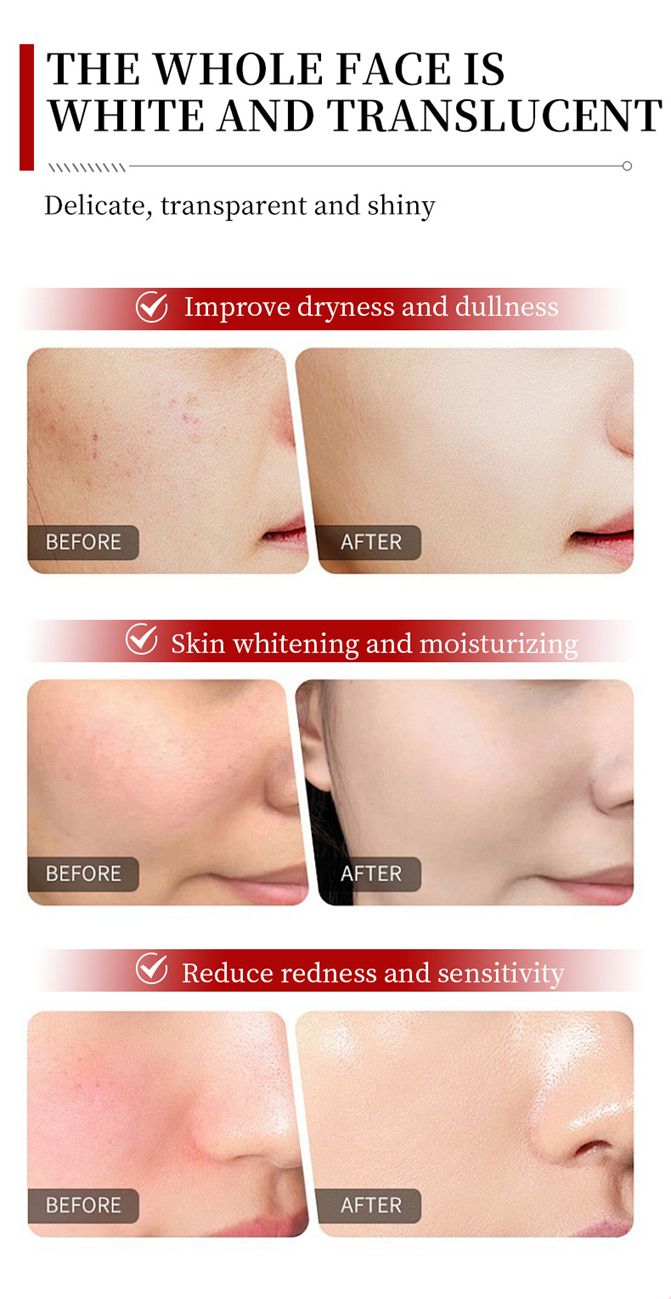 MOIKA Retinol B3 Essence Hydrating, Moisturizing, Locking Water, Anti-wrinkle and Firming