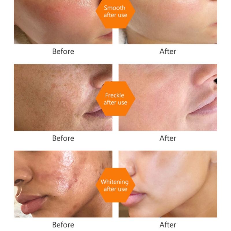 Dark Spots Eraser Turmeric Toner 100ml Beauty Care makeup whitening