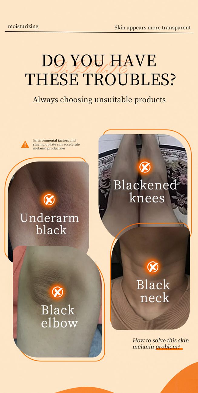 MOIKA Underarm Brightening Repair Cream Hydrates and Nourishes the Skin