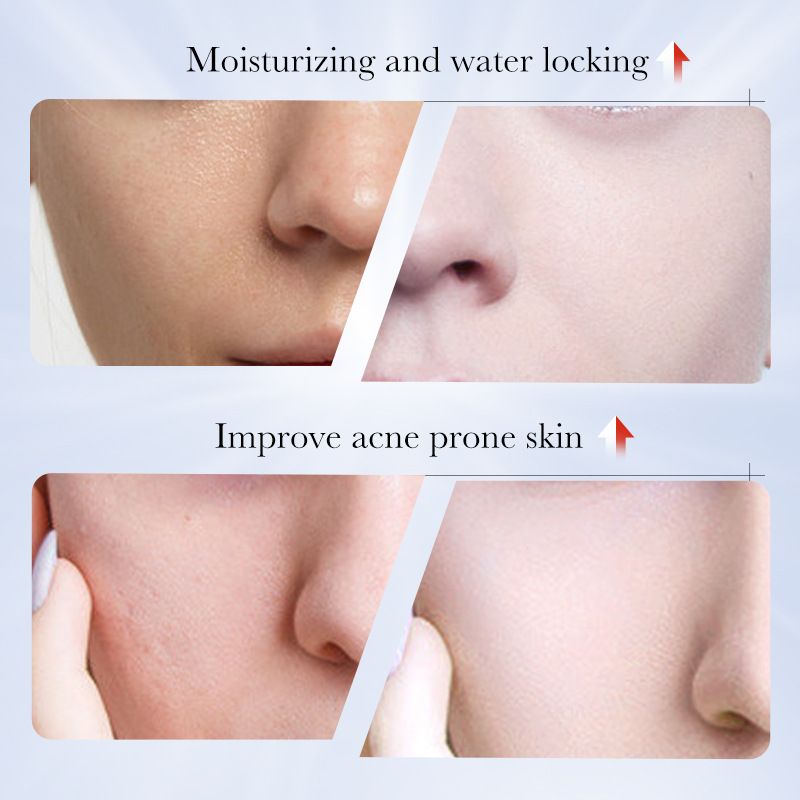 Kojic acid whitening and anti-freckle cream,Brightening and rejuvenating skin to remove melanin cream,whiten freckles face cream,kojic acid face cream
