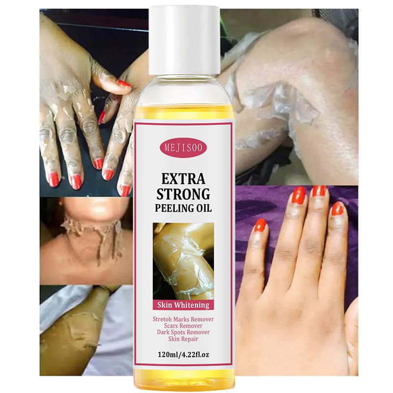 Whitening Peeling oil Tear off dead skin, clean, exfoliate, oil, yellow skin oil CRRSHOP Body Oil ,120ml Exfoliating oil