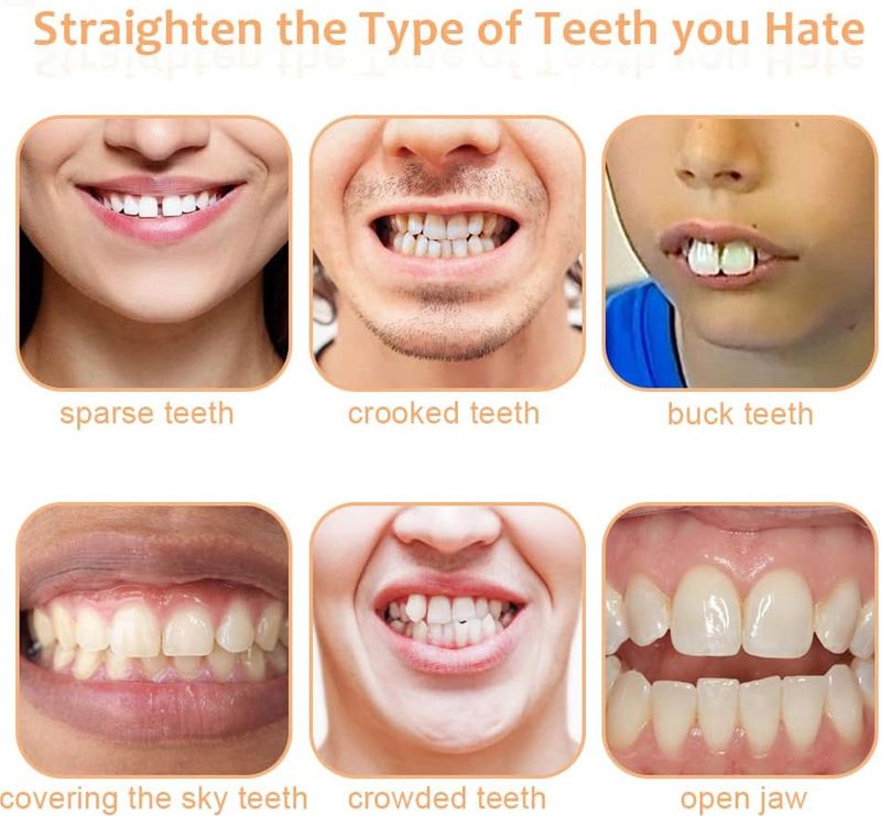 Fourth generation instant smile dentures with silicone simulated teeth, whitening braces, and smiling dentures