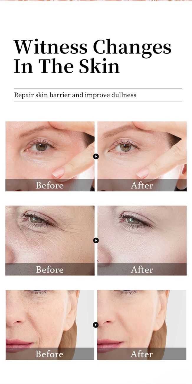 5 in 1 essence moisturizing, hydrating, moisturizing, anti-wrinkle and brightening skin tone