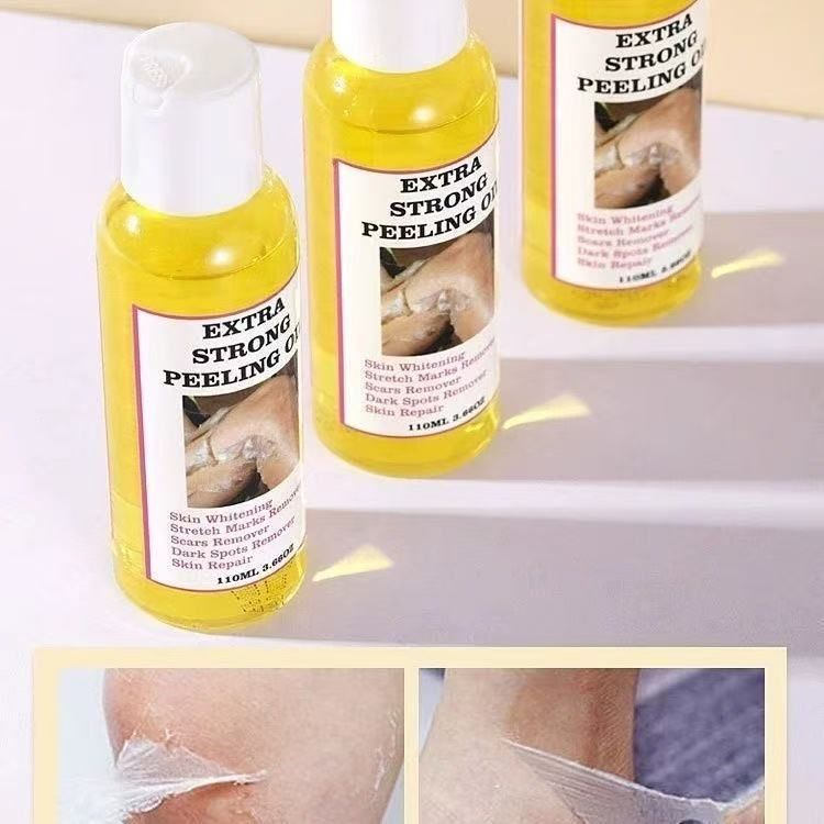 Yellow Peeling Oil, cross-border peeling oil, exfoliating oil, elbow, knee, finger, black skin oil