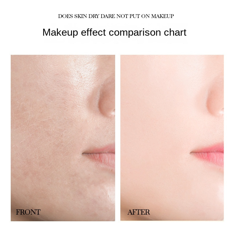 HKCQCQ ectoine yeast essence skin rejuvenation repair nine-piece set moisturizing hydrating beauty skin care
product box