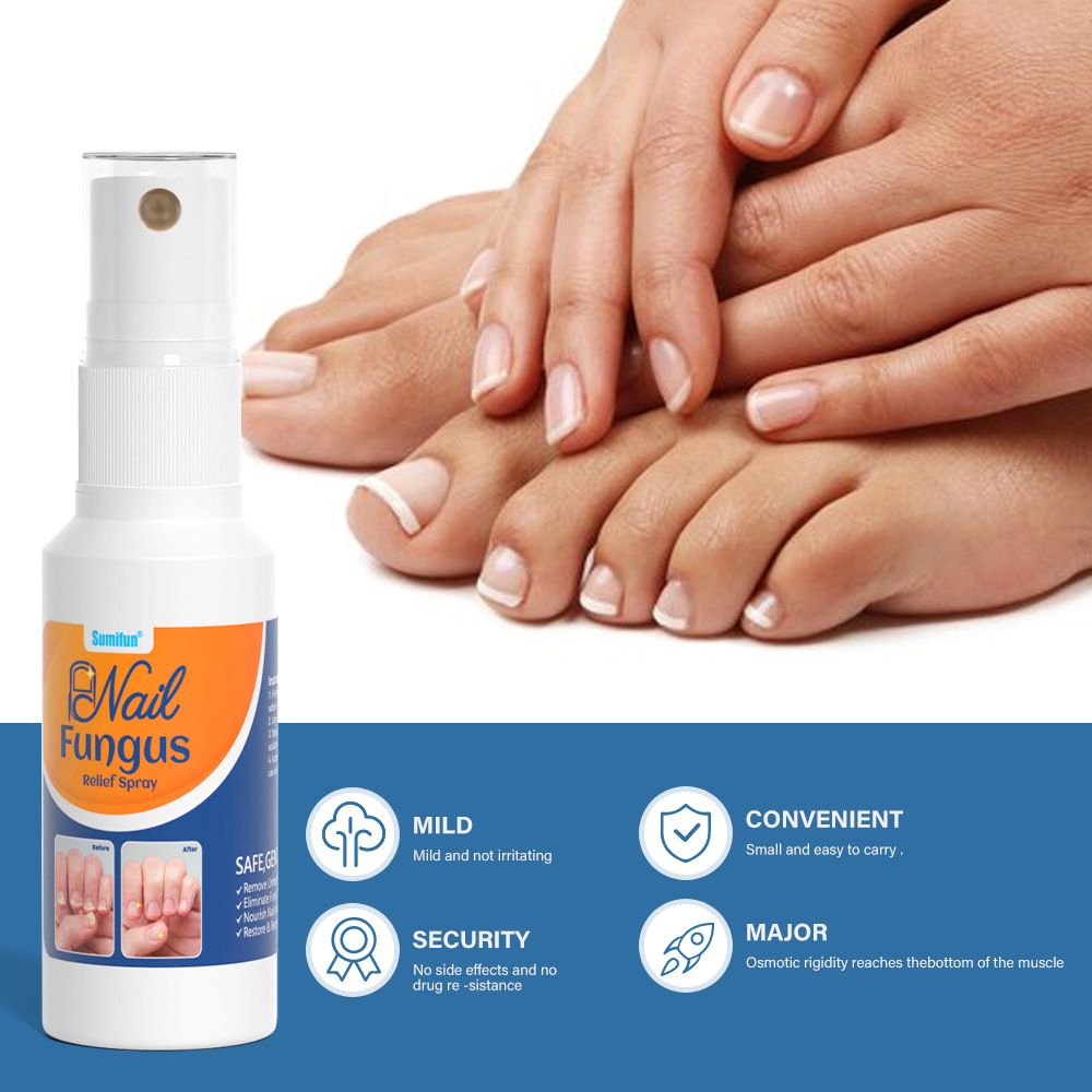 Sumifun K50010 Nail Fungus Care Spray | Toenail & Fingernail Repair Liquid | External Anti-Fungal Health Care Spray for Discolored, Brittle Nails
