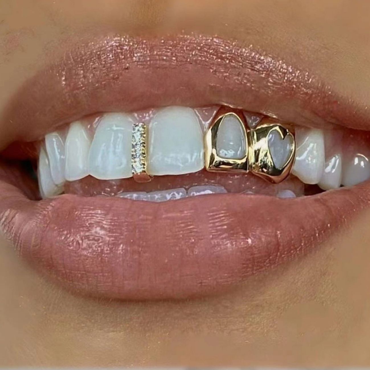 Hollow love double grillz for daily wear, cool and shiny gold and silver teeth, hip-hop and versatile,hip-hop teeth grillz tooth grillz hip-hop grillz,gold teeth,silver teeth