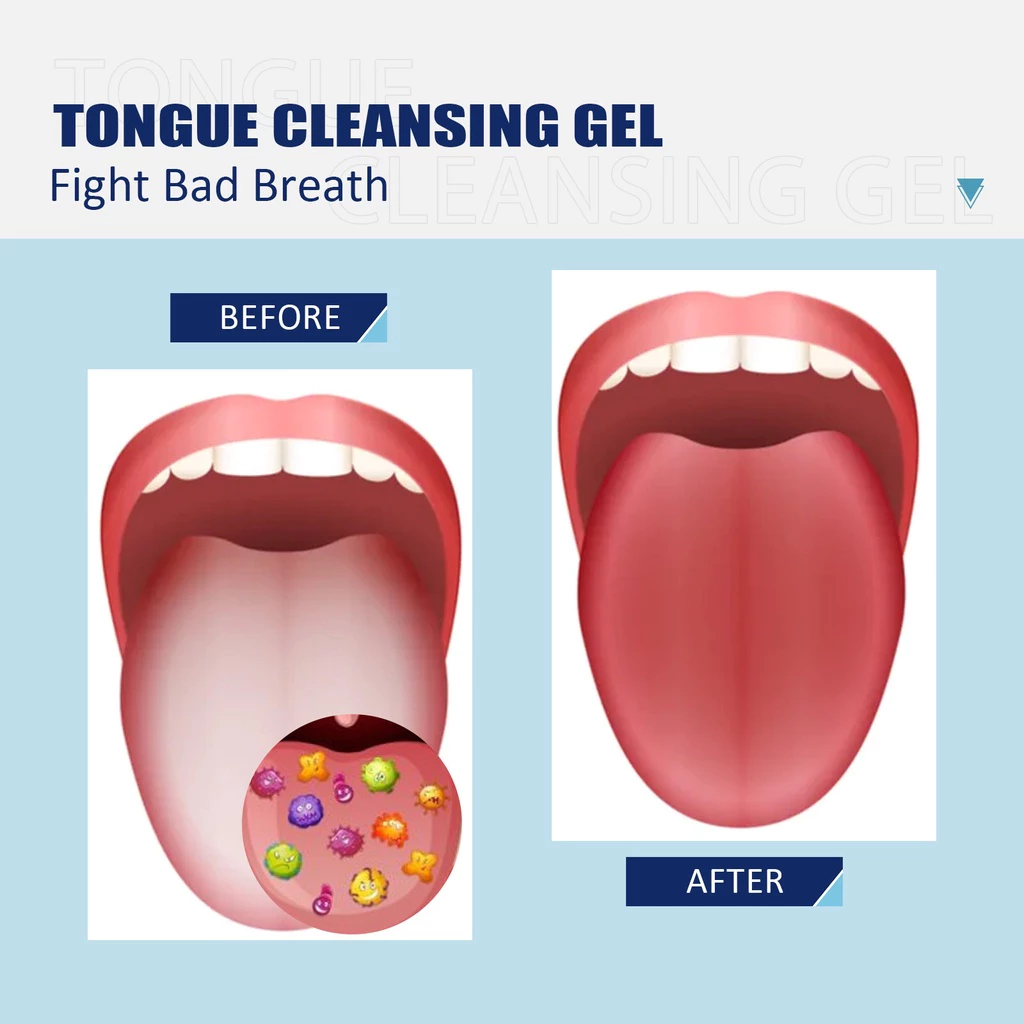 Eelhoe Tongue Coating Cleaning Gel Brush Scraper Oral Care Prevents Uccers Remove Odors Fresh Breath Effectively Inhibit