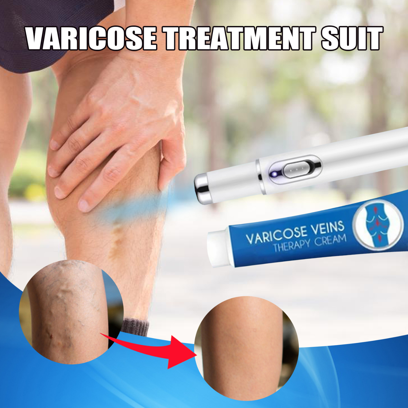 Varicose Veins Treatment Suit Home Use, Relief Pain for Vasculitis Phlebitis Gel, Portable Blue Light Therapy Varicose Veins Pen Fast and Efficient