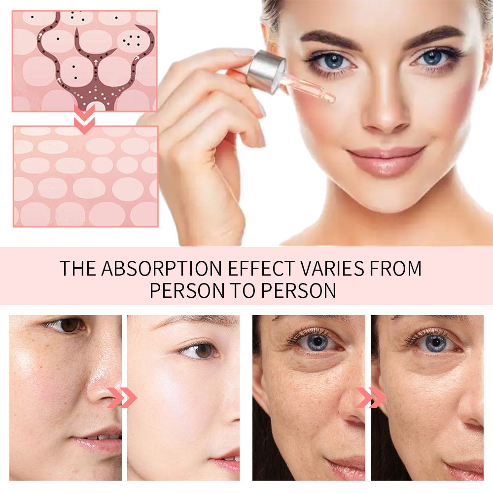 5in1 serum essence to brighten skin tone 5 in 1 skin care facial vc essence