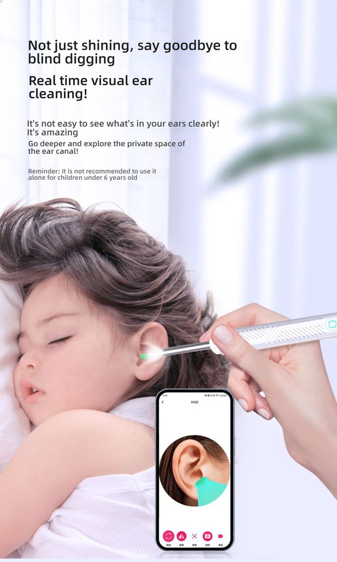  Wireless Smart Visual Ear Cleaner with HD Camera, LED Light, Connects to Phone for Adults & Kids - Safe & Easy Ear Wax Removal Tool 