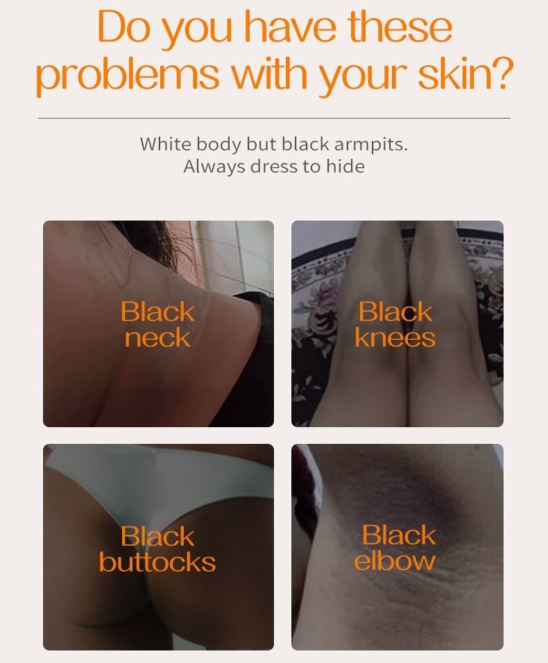 Underarm light black and tender white cream, Whitening Cream moisturizing and hydrating CRRSHOP tender and delicate skin, enhancing and moisturizing the skin, skincare products