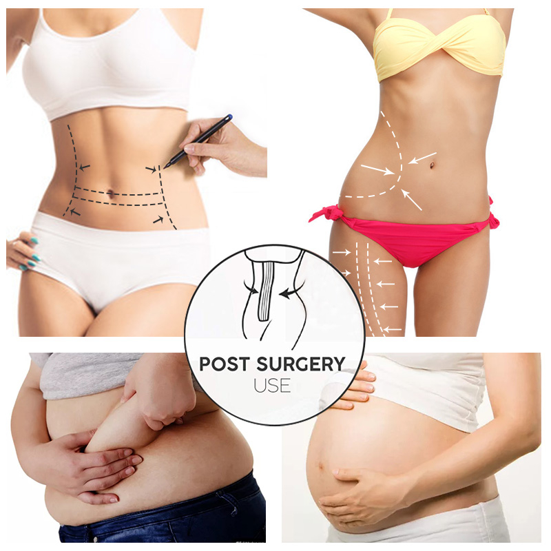 Wrap Waist Trainer Shaperwear Belt Women Slimming Tummy Belt Corset Top Stretch Bands Cincher Body Shaper Snatch Me Up