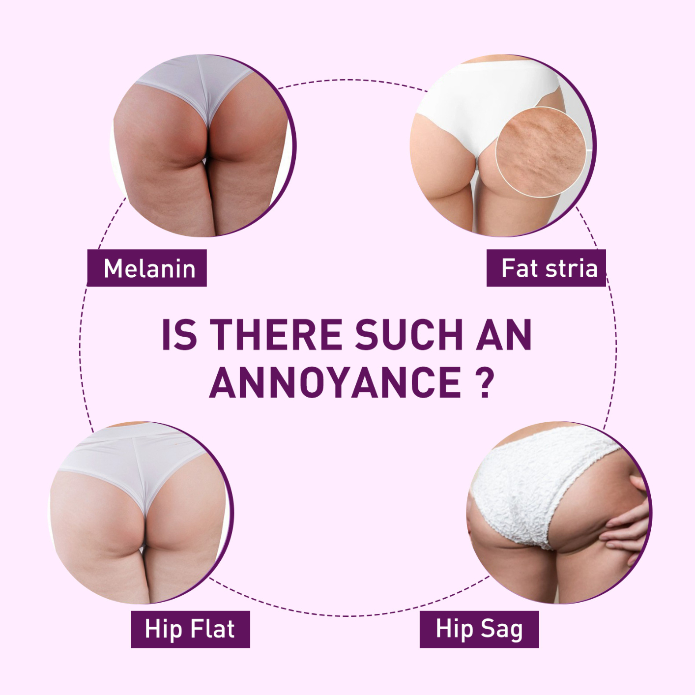 Plump Up Booty Enhancement Oil, Booty Enhancement Oil, Hip Lift Up Essential Oil, Hiplift Buttocks Essential Oil, Hip Lifting Massage Oil, Butt Firming Enhancement Essential Oil for Women