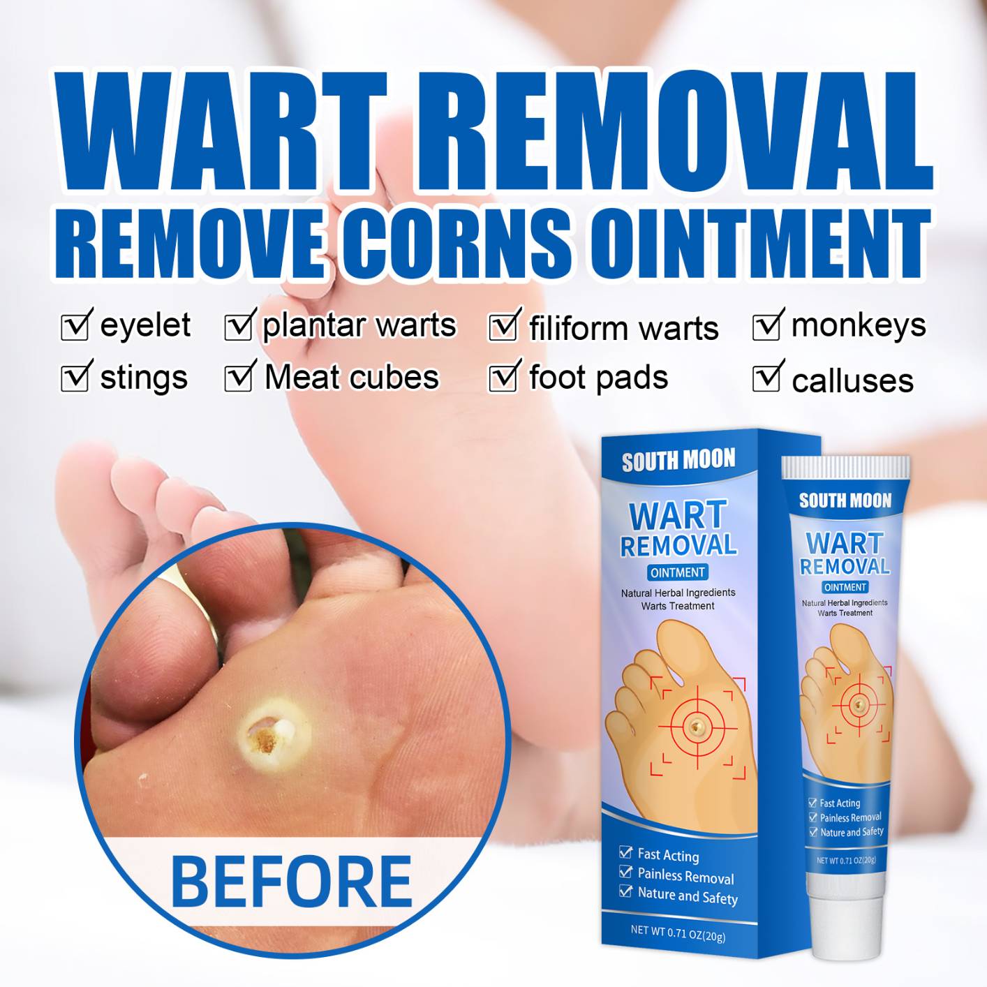 Skin Tag Remover, Warts Remover Cream,Quickly and Easily Remove Common Skin Tag, Wart and Callus