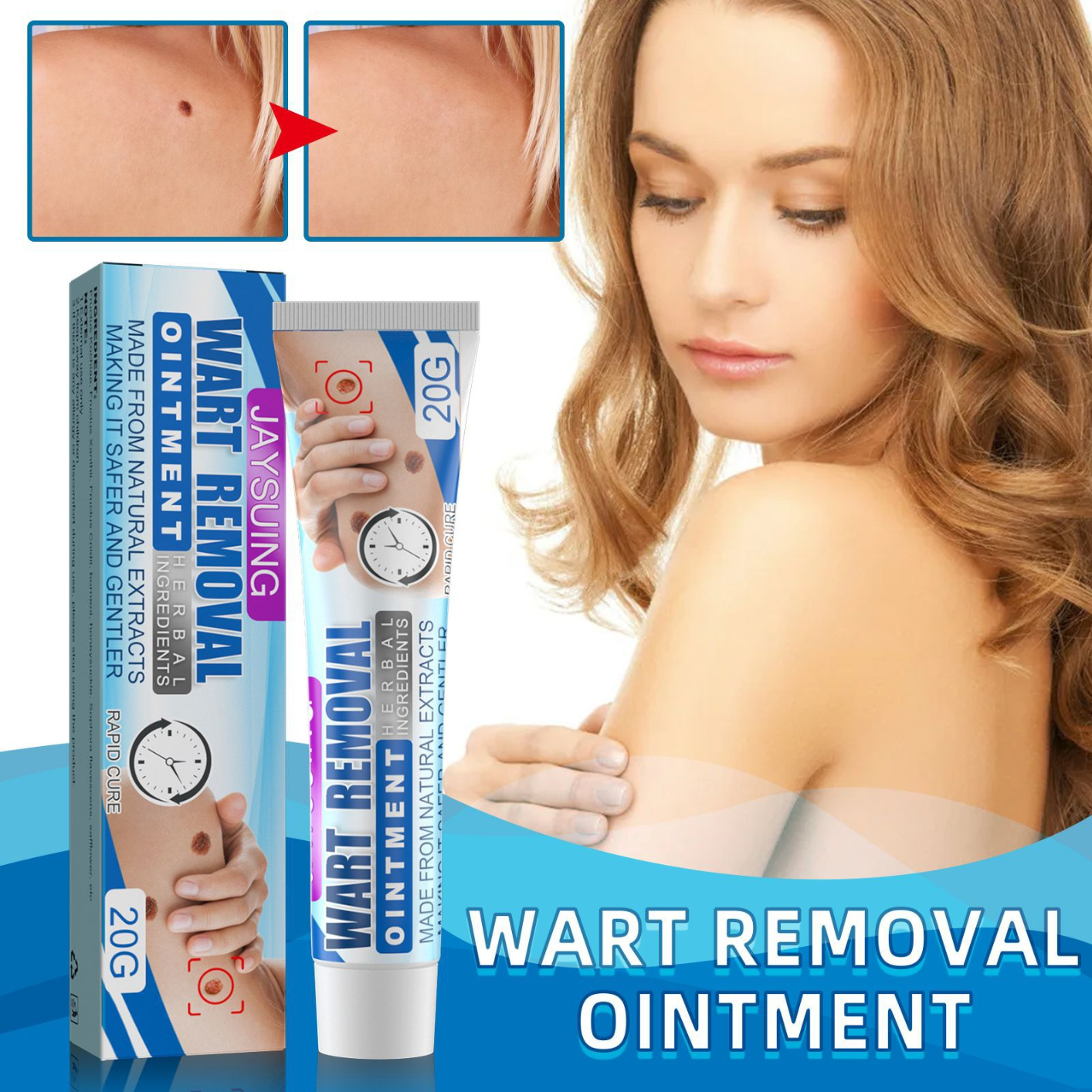 Wart Remover, Instant Blemish Removal Gel, Skin Wart Removal Cream Body Warts Treatment Cream Foot Care Cream Skin Tag Remover