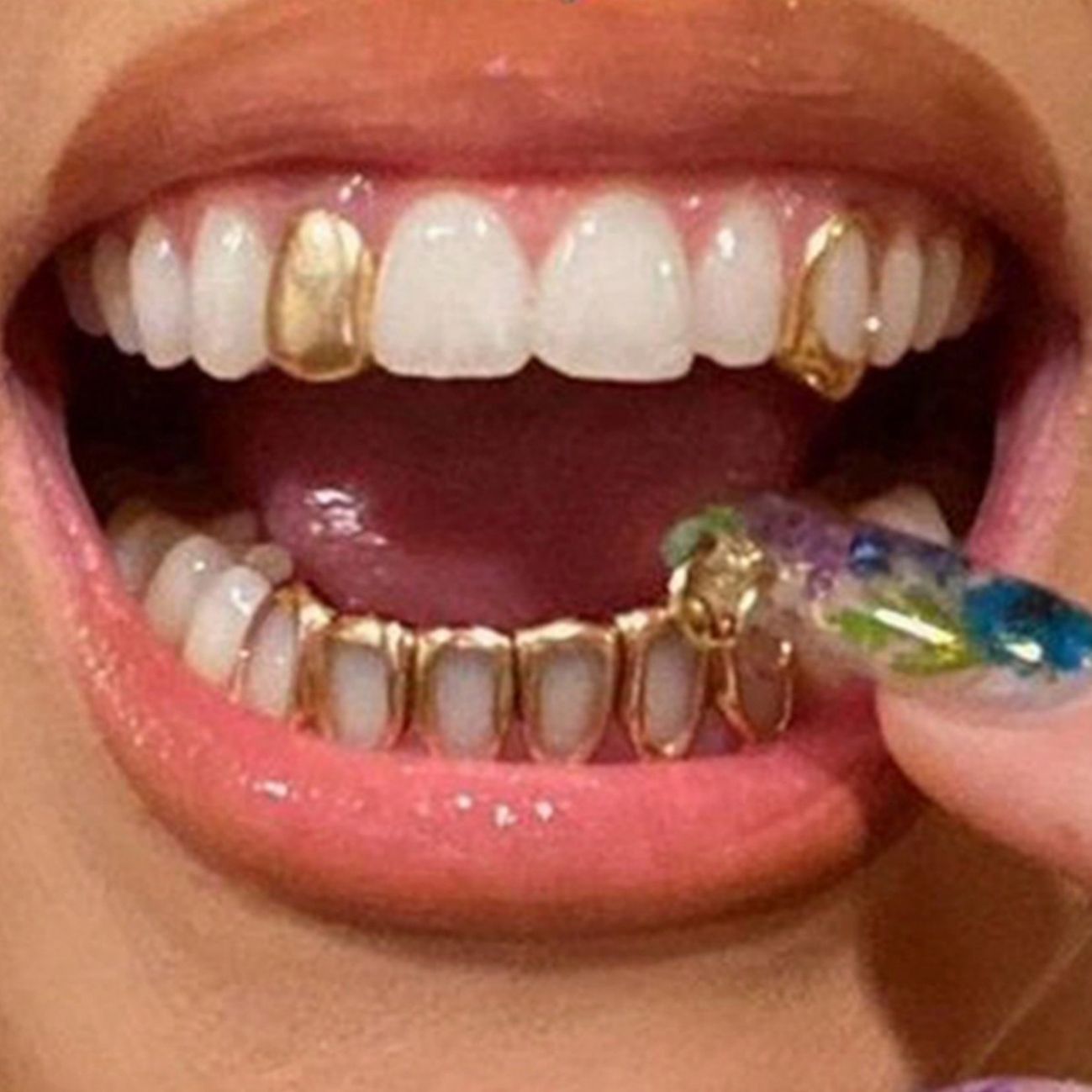 Hip-hop grillz three-piece set, single upper teeth + six-tooth hollow lower teeth gold teeth silver teeth rose gold teeth gold grillz silver grillz rose gold grillz