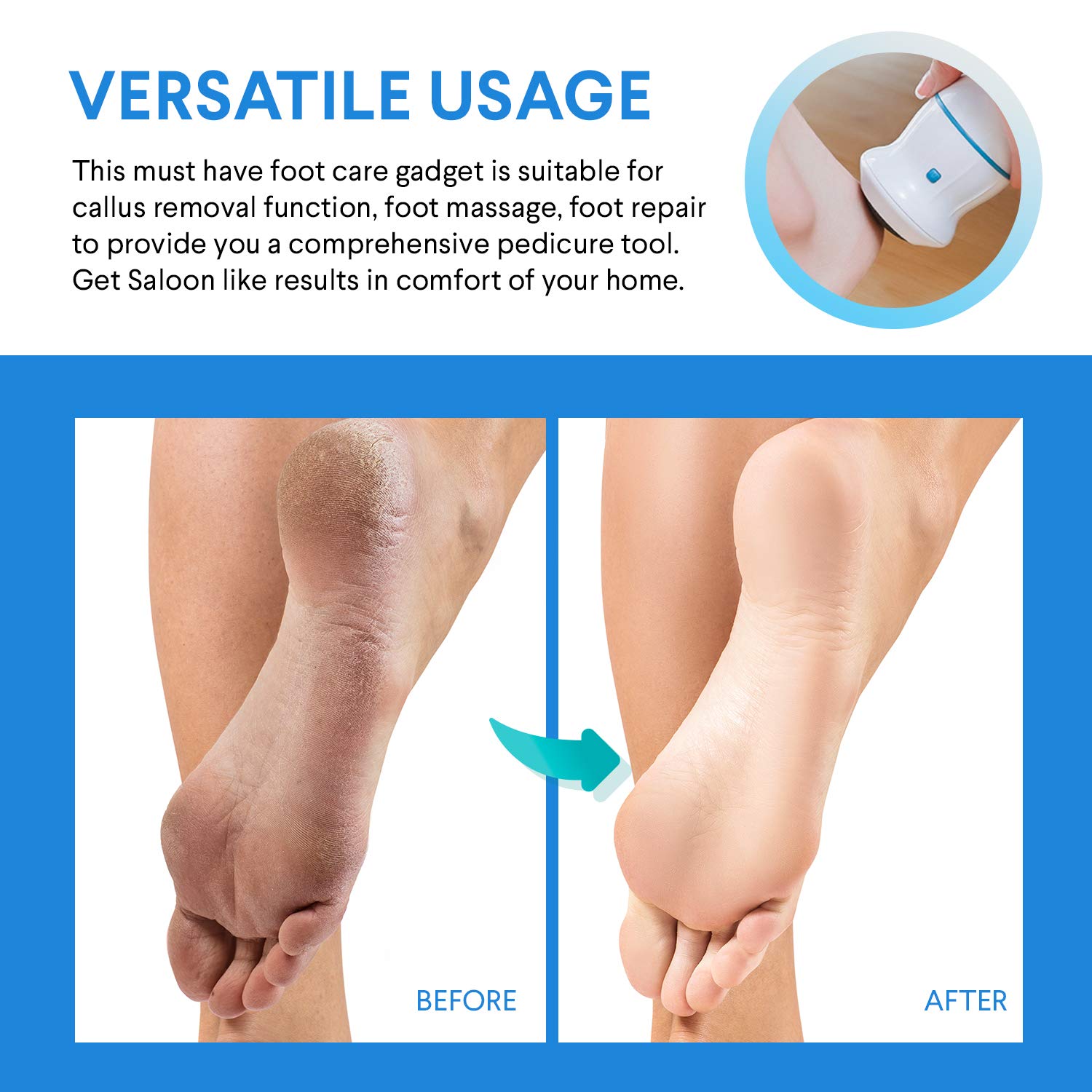 Portable Electric Foot Grinder - USB Electronic Foot File, Pedicure Foot Care Tools - Dual-Speed Callus Remover for Dead Hard Cracked Dry Skin - Foot Heel Repair