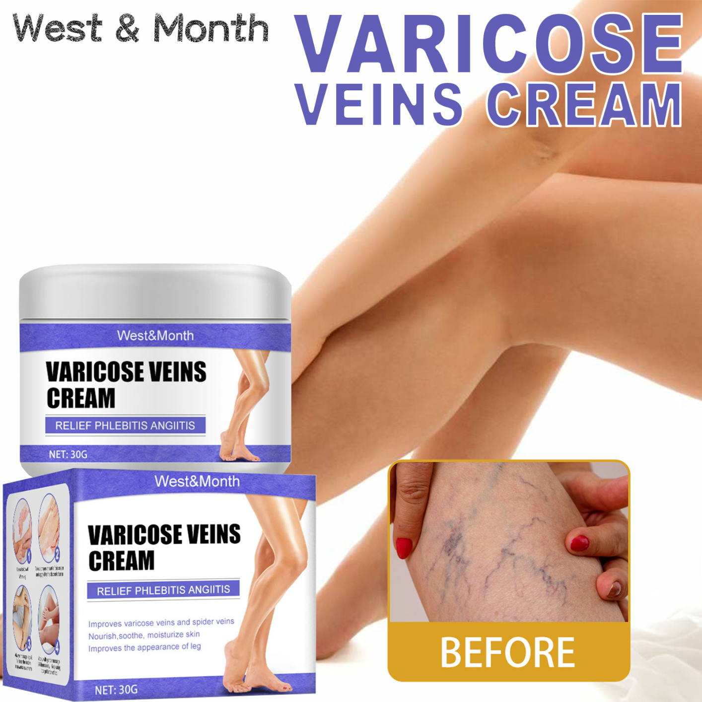 Varicose Veins Cream, Soothing Leg Cream with Natural Ingredients Improve Blood Circulation, Relieve Pain of Legs