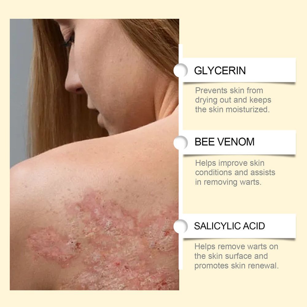 SOUTH MOON Bee Venom Cream Relieves Redness Repair Damage Skin Strengthens Skin Barrier Deep Moisturizing Skin Care Nourishing Body Cream