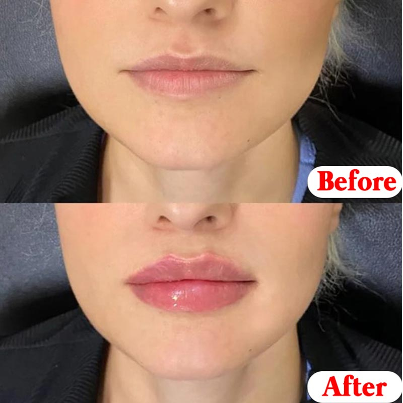 9973 6/8 Pcs Lip Balms Moisturizing Refreshing Non-sticky Fruit Series Anti-Cracked Lip Treatment Vaseline for Makeup Lip Gloss Set
