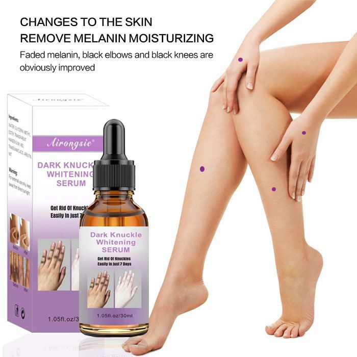 DarkKnuckles Whitening,Finger joints darkening serum, elbow and knee brightening serum