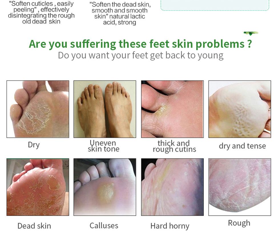 Aloe Vera Foot Mask Peeling for Legs Feet Mask Scrub Exfoliating Socks for Pedicure Anti Crack Heel Remove Skin Foot Patch
