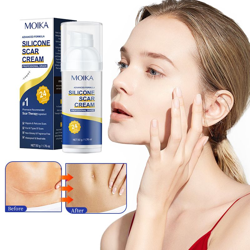 MOIKA Scar repair cream deeply repairs and smoothes bumps, smoothes skin, anti-wrinkle and moisturizing cream