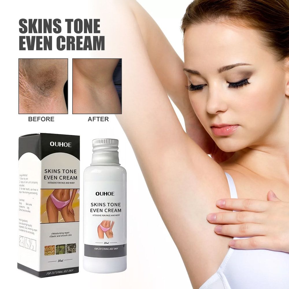 OUHOE Body Skin Bleaching Cream Private Parts Whitening Armpits Thigh Crotch Melanin Pigment Dark Spot Remove Lighten Body Care Lotion
