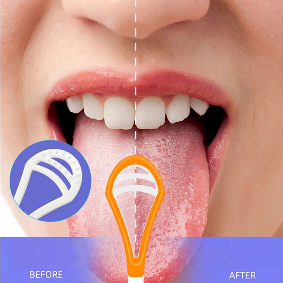 Tongue Cleaner For Adult Reusable Double-sided Tongue Cleaning Scraper Brush Professional Tongue Cleaner Oral Care Tools
