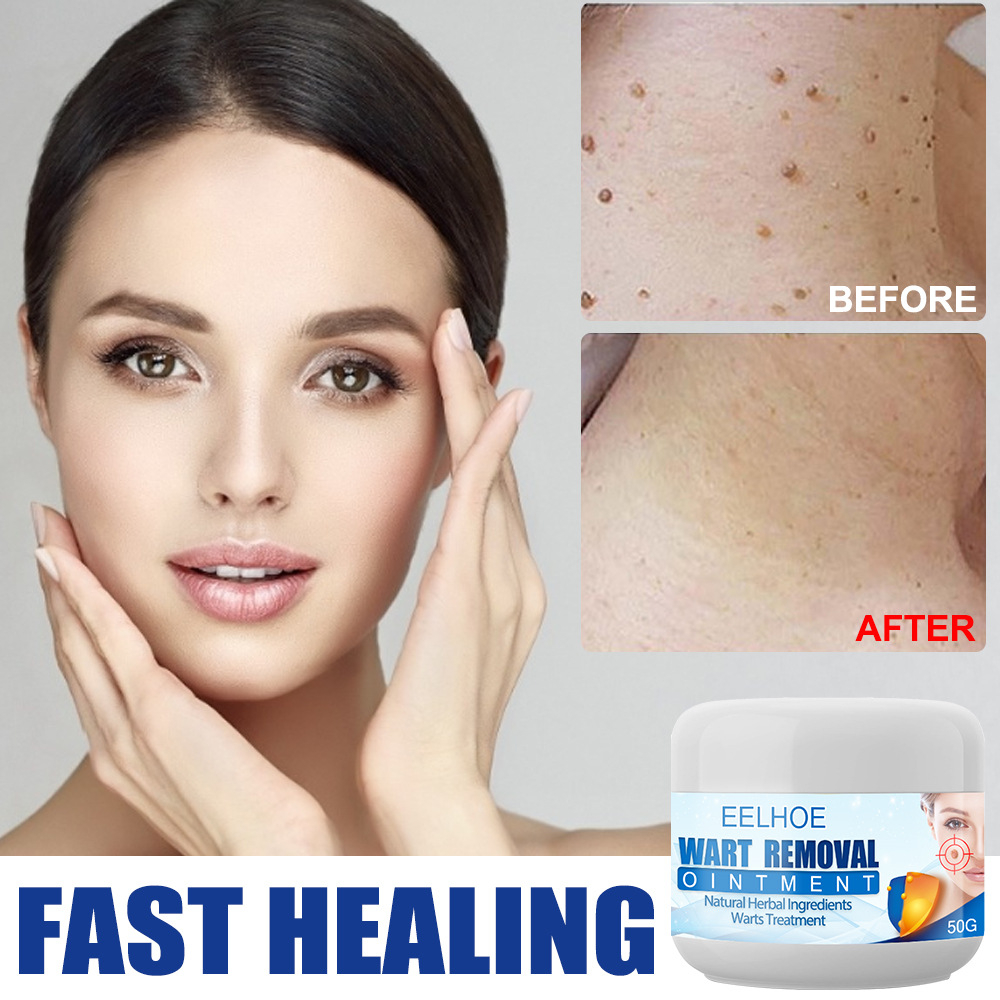 Wart Removal Cream Jar Packed, for Body Skin Tag Remover, Common Wart, Safe and Effective