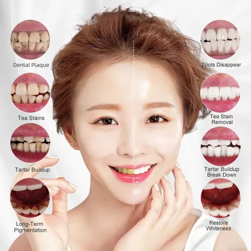 Teeth Whitening Essence Stains Yellow Teeth Treatment Smoke Coffee Plaque Dental Oral Hygiene Remove Whitening Tooth Care