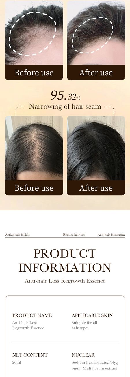 ZOZU Anti-hair loss essence strengthens hair roots, improves hair loss and promotes hair growth