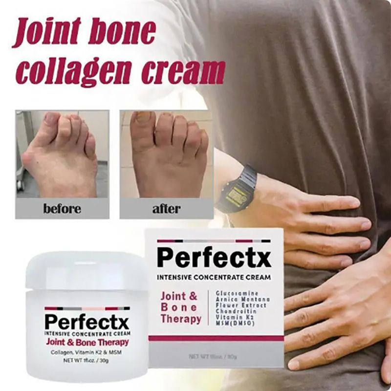 Perfectx Counterpain Cream Joint Bone Pain Relief Cream Orthopedic Valgus Corrector Knee Muscle Arthritis Treatment Ointments