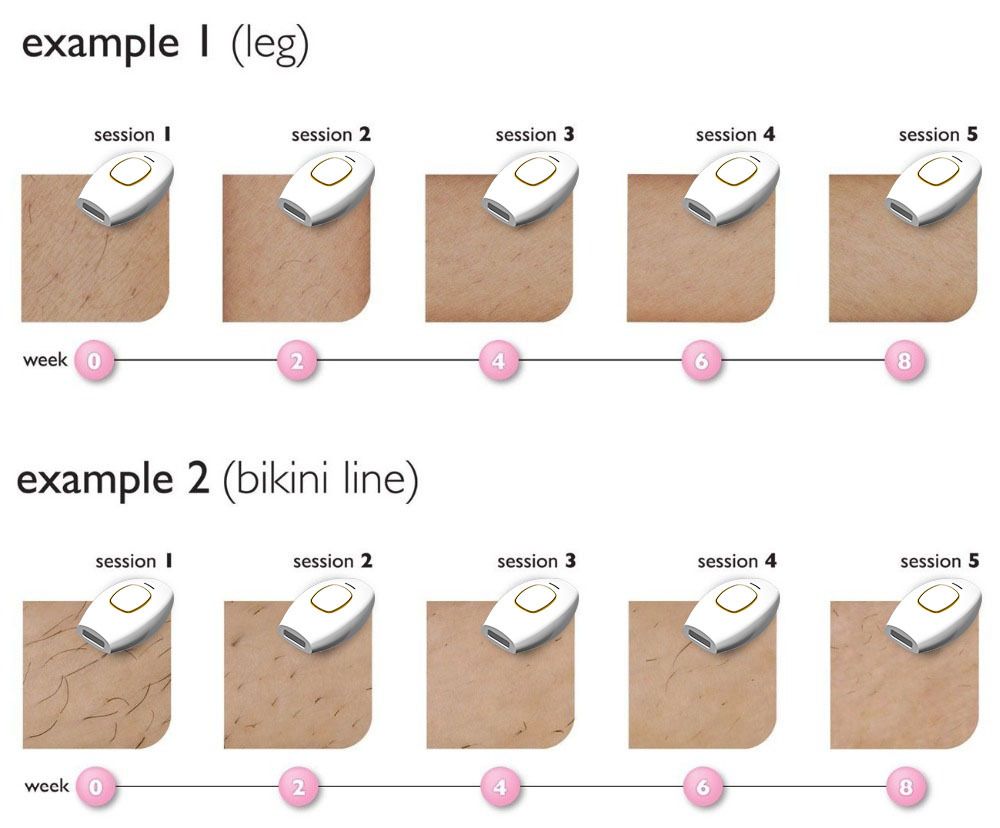 Bread style laser hair removal device IPL household women's shaving strong pulse hair removal device electric hair removal device