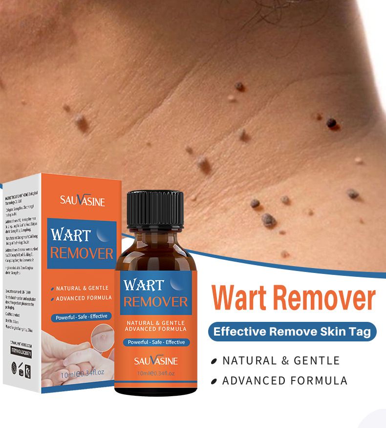 SAUVASINE wart removal liquid, warts, flat warts, especially condyloma acuminatum, wart removal liquid, moisturizing facial wart removal liquid
