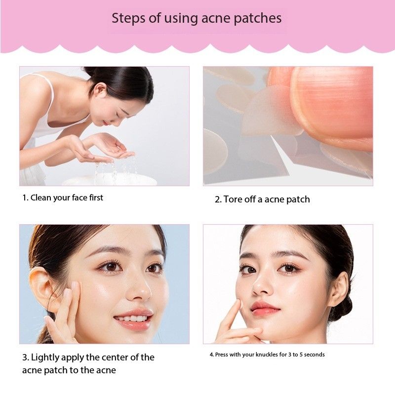 Classic Acne/Pimple Patches 36pcs (2 Sizes) | Invisible & Fast Healing