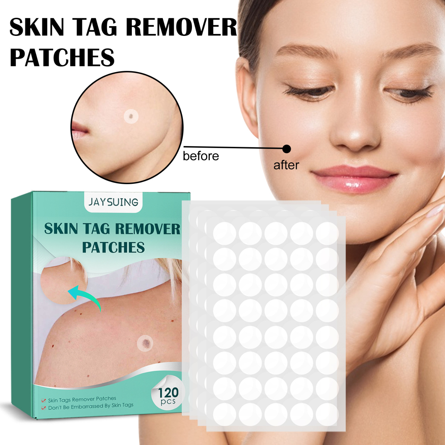 120PCS Skin Tag Remover for 2-5mm Skin Tag, Skin Tag Remover Patches, Face Care Mole Wart Tool, Green Skin Tag Removal Kit, Easy to Use