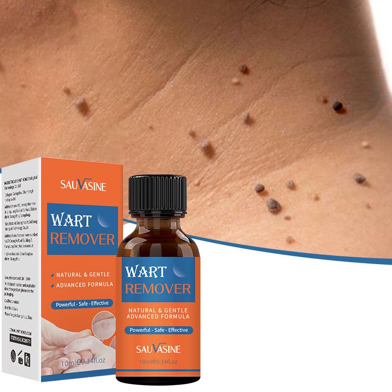 SAUVASINE wart removal liquid, warts, flat warts, especially condyloma acuminatum, wart removal liquid, moisturizing facial wart removal liquid