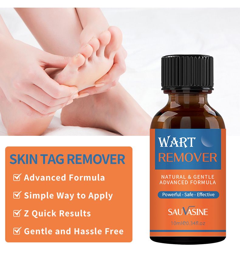 SAUVASINE wart removal liquid, warts, flat warts, especially condyloma acuminatum, wart removal liquid, moisturizing facial wart removal liquid