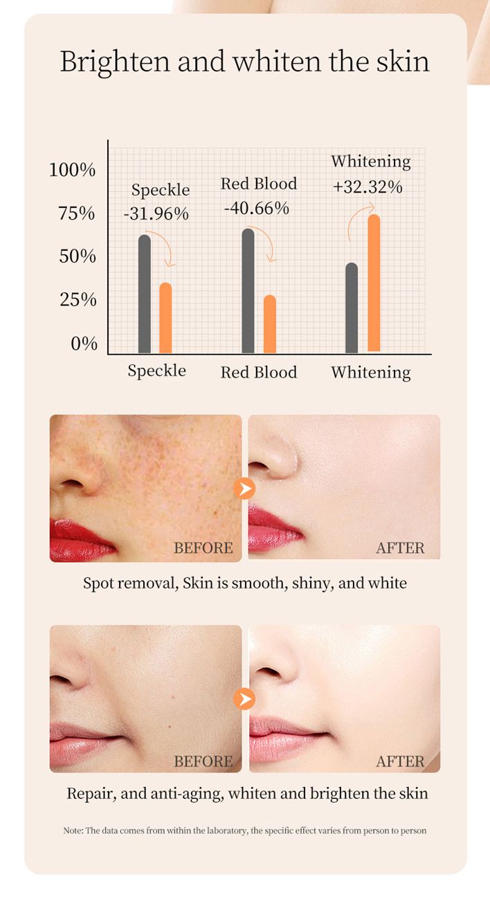 MOIKA Whitening and Anti-Freckle Essence Anti-Wrinkle Firming Skin Care Essential Oil