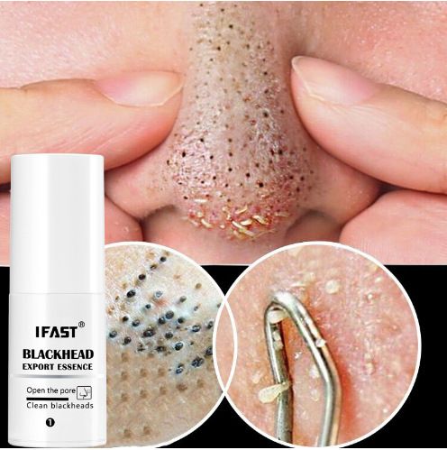 Blackhead export liquid deeply cleanses and shrinks pores, delicate and soft, and removes blackhead nasal mask