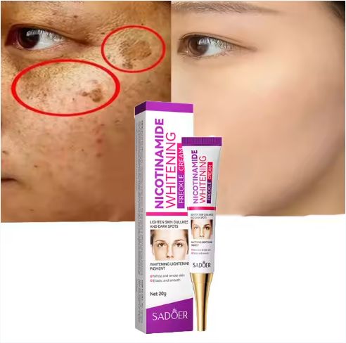 Nicotinamide Anti Whitening Freckle Moisturizing Toner