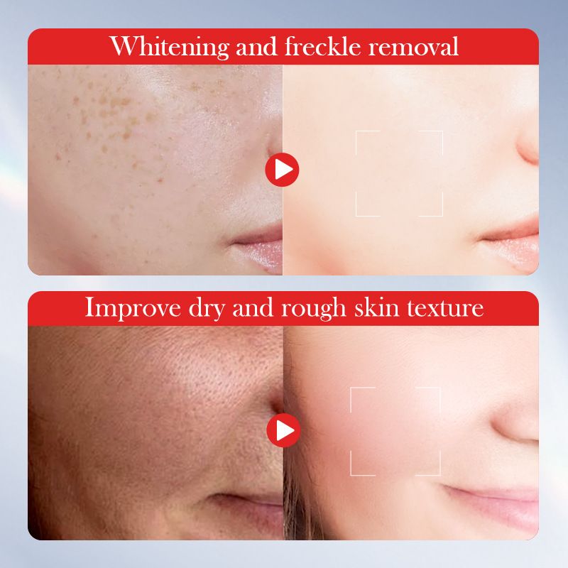 Whitening, freckle removing cream, 50g SADOER, moisturizing, brightening, rejuvenating, face cream CRRSHOP Beauty Care