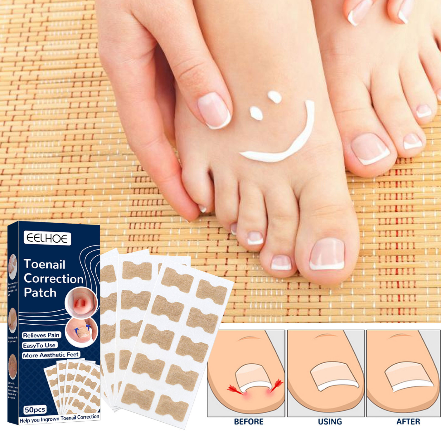 50Pcs Fertoe Toenail Corrector Patch - Ingrown Toe Nail Correction Sticker, Health Toenail Corrector Patch, Ingrown Toenail Tool