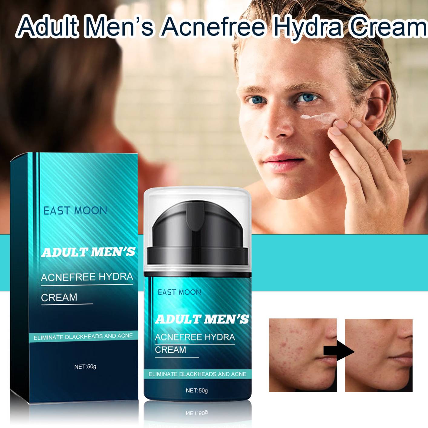 Men's Acnefree Hydra Cream Whitening Cream for Dark Skin Remove Spots Acne Marks Skincare Niacinamide Brightening Anit-Aging