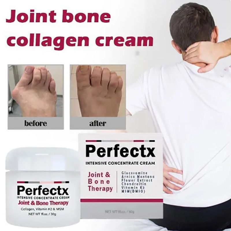 Perfectx Counterpain Cream Joint Bone Pain Relief Cream Orthopedic Valgus Corrector Knee Muscle Arthritis Treatment Ointments