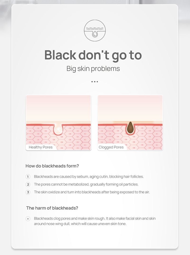 Blackhead export liquid deeply cleanses and shrinks pores, delicate and soft, and removes blackhead nasal mask
